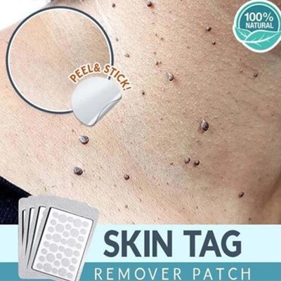 Skin-Tag-Remover Patch Acne-Cream Ance Hydrocolloid Plaster