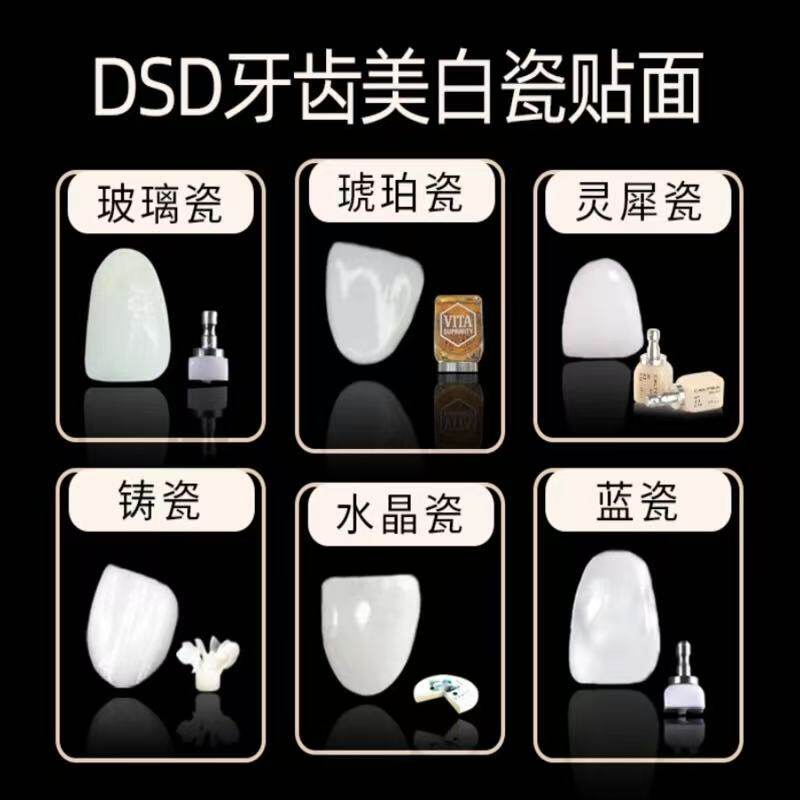牙齿贴片牙齿瓷贴面全瓷牙贴面义获嘉美白牙贴牙齿贴面超薄牙贴片