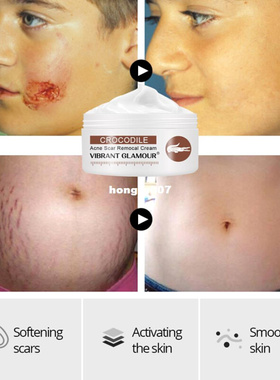 速发pge r Sc Ati -Wrikle ARig