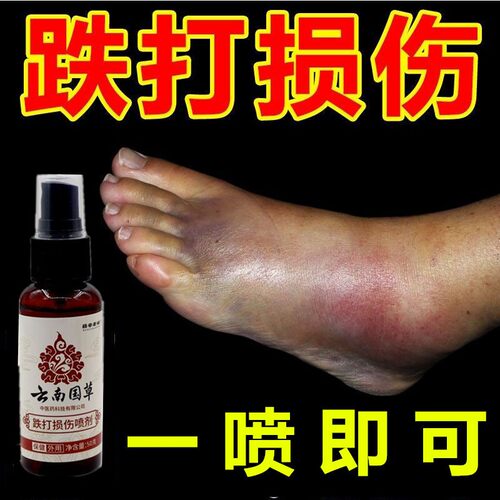 云南国草白药跌打损伤喷剂舒筋筋伤动骨脚踝扭伤