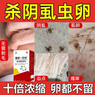 虱疥喷剂一扫光学生去虱子儿童头虱专用祛虱卵洗发水虮子大人阴虱