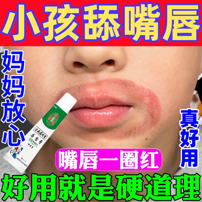 儿童羊胡子疮小孩舔嘴唇起泡嘴巴一圈红干裂脱皮口周炎修复唇膏药