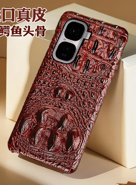 月梵希适用iqooNoe10鳄鱼头骨纹iqooNoe10pro商务至臻3D鳄鱼iqooNoe9s真皮新款iqooNoe9spro奢半包手机壳
