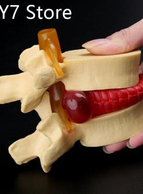 Medical props model Free postage Anatomical Spine Lumbar Dis