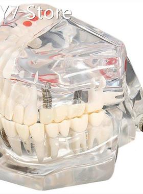 Tooth model model dental care model denture dentist Dental D