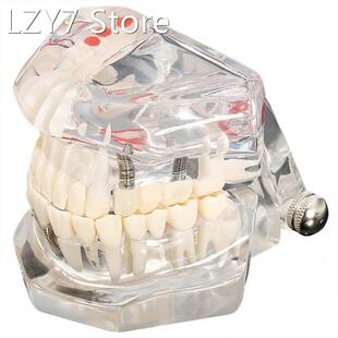 Tooth model model dental care model denture dentist Dental D