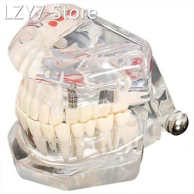 Tooth model model dental care model denture dentist Dental D