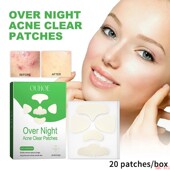 Acne Pimples Patches Chin Invisible Cheek Nose Forehead Remo