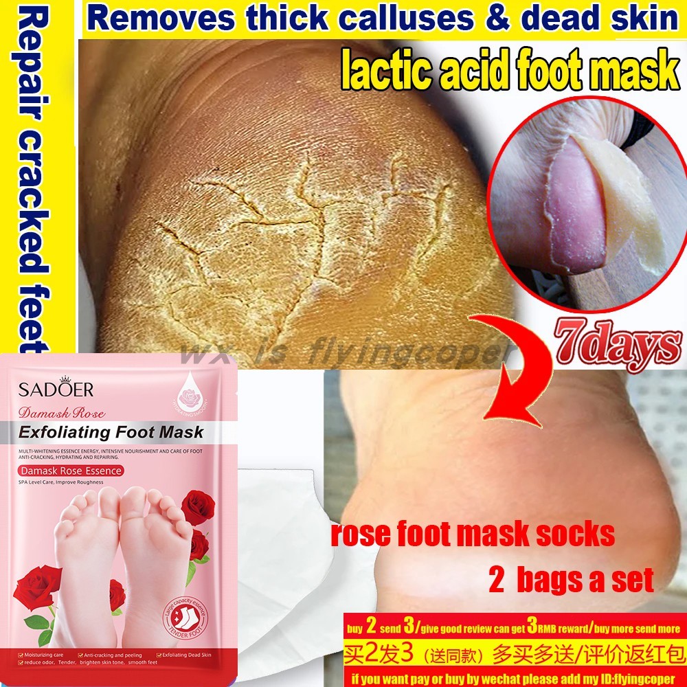 Moleskin Pad Adhesive Blister Tape Foot Protection足部防磨贴