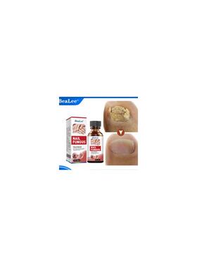 iBeaLee 7DAYS Repair Nail Fungus Treatments Essence Foot Car