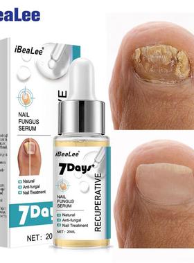 iBeaLee 7DAYS Repair Nail Fungus Treatments Essence Foot Car