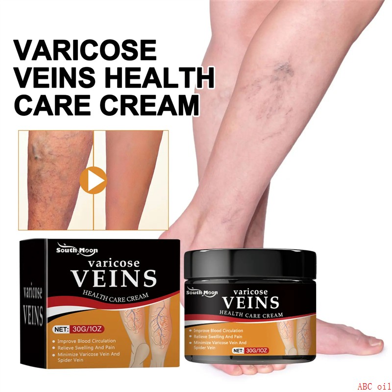 Vein Repair Cream Relieves Swollen and Sore Legs Repairs Ear