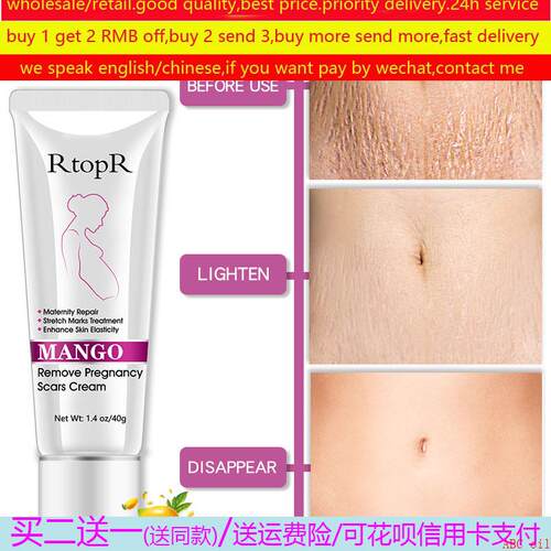 Mango Remove Pregnancy Scars Acne Cream stretch Mark去纹痕霜
