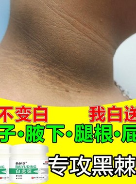 脖子黑色素去除颈部洗不干净黑棘皮嘴角腋下关节大腿内侧美白神器