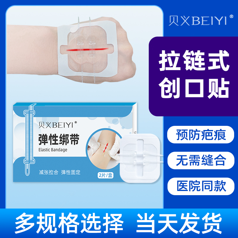 贝义医用减张器皮肤疤痕减张免缝