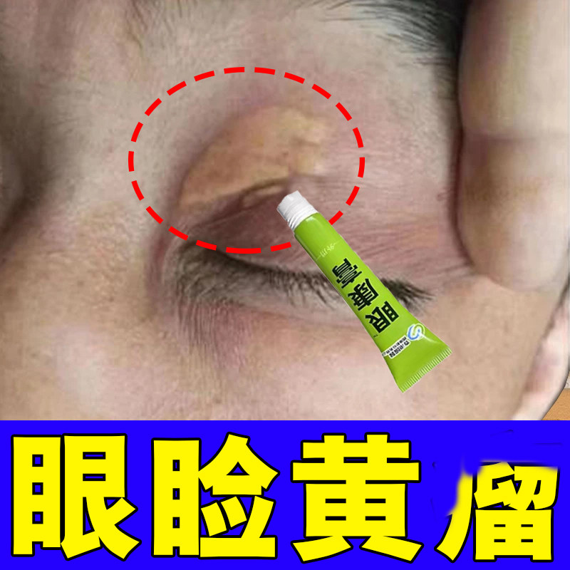 眼睑黄溜去除膏眼部睑脂肪粒眼角黄斑黄色肉块斑块去除眼膏
