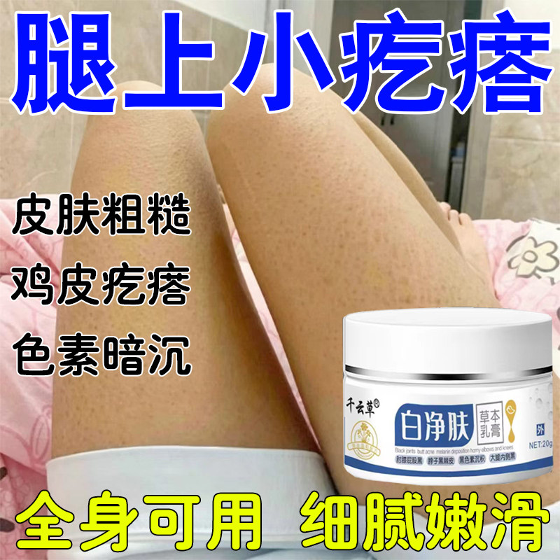 去腿部鸡疙瘩皮鱼鳞肤小黑点毛角囊质皮粗糙肤黑沉淀色素全身可用