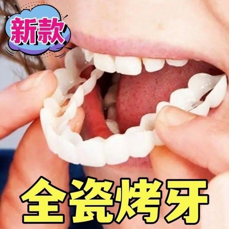 牙套吃饭神器新款真牙套无洞假牙老人咀嚼通用塑形缺补牙假牙套