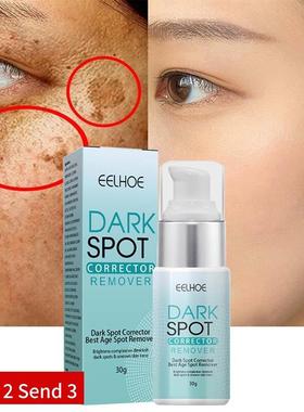 Nicotinamide Whitening Freckle Cream Dark Spot Remover Skin