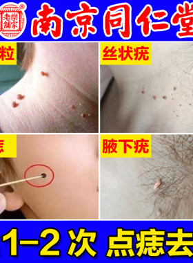【南京同仁堂】无痕点志去尤