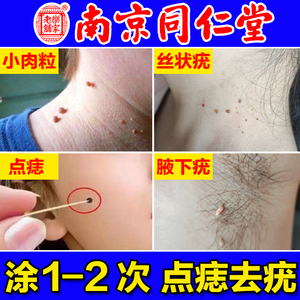 【南京同仁堂】无痕点志去尤