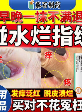 手指缝溃烂开裂烂痒水泡脱皮糜烂搭长期泡水烂手丫脱皮软膏药贴QN