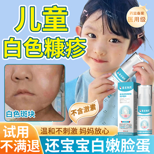 白色糠疹药监备案膏儿童脸上长白斑汗斑花斑藓小孩子宝宝脸部QN