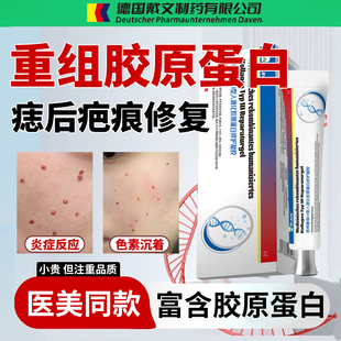 淡化点痣后去疤痕修复红印除疤膏凹陷性痘印黑色素沉淀疤痕贴YG