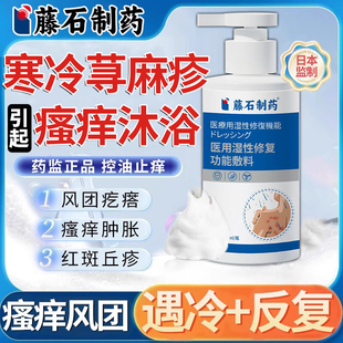 寒冷性寻荨麻疹过敏止痒断沐浴露根提高免疫力寻麻疹膏QN