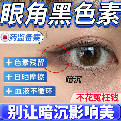 【眼角黑色素沉淀】黑斑黑印