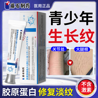 去除肥胖纹生长纹消除大腿修复霜