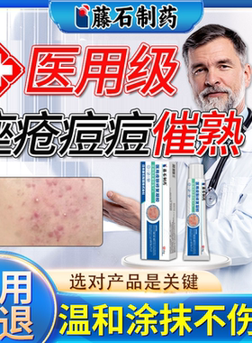痘痘催熟膏淋巴痘腮边痘结节硬块痘下巴反复长痘内调药监备案QN