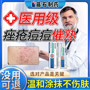 痘痘催熟膏淋巴痘腮边痘结节硬块痘下巴反复长痘内调药监备案QN