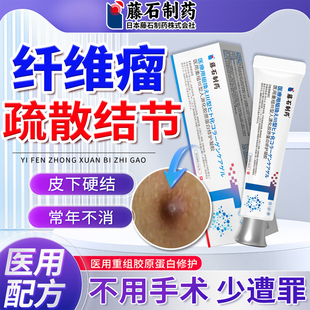 皮肤纤维瘤去药监备案膏除硬块疙瘩结节皮下消脂肪瘤鼓包肿块JQ
