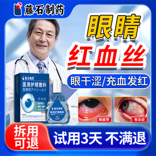 去眼睛红血丝抗疲劳眼白发黄眼睛清澈去黄血丝可搭眼药水滴眼液YF
