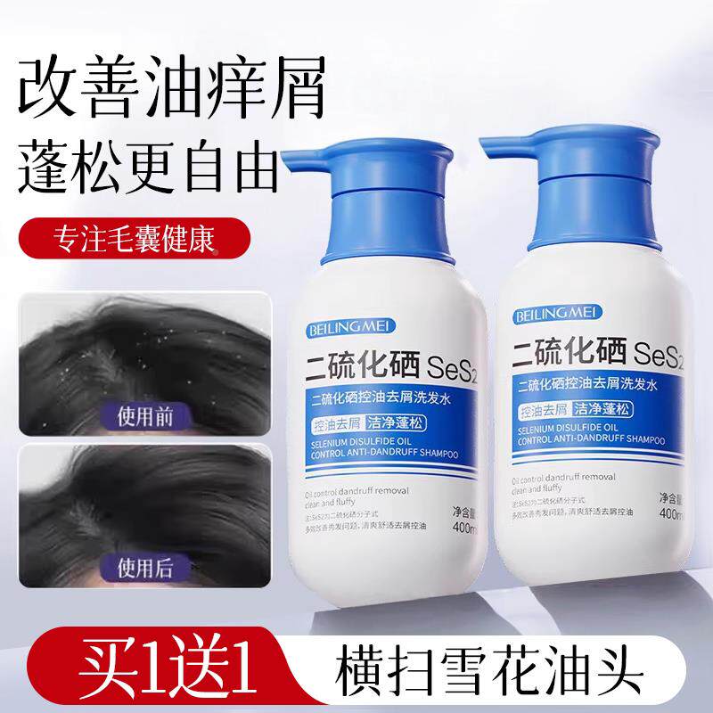 雪退花头原地散~二硫ONF化硒屑发水去控油蓬松洗洗头发膏官方