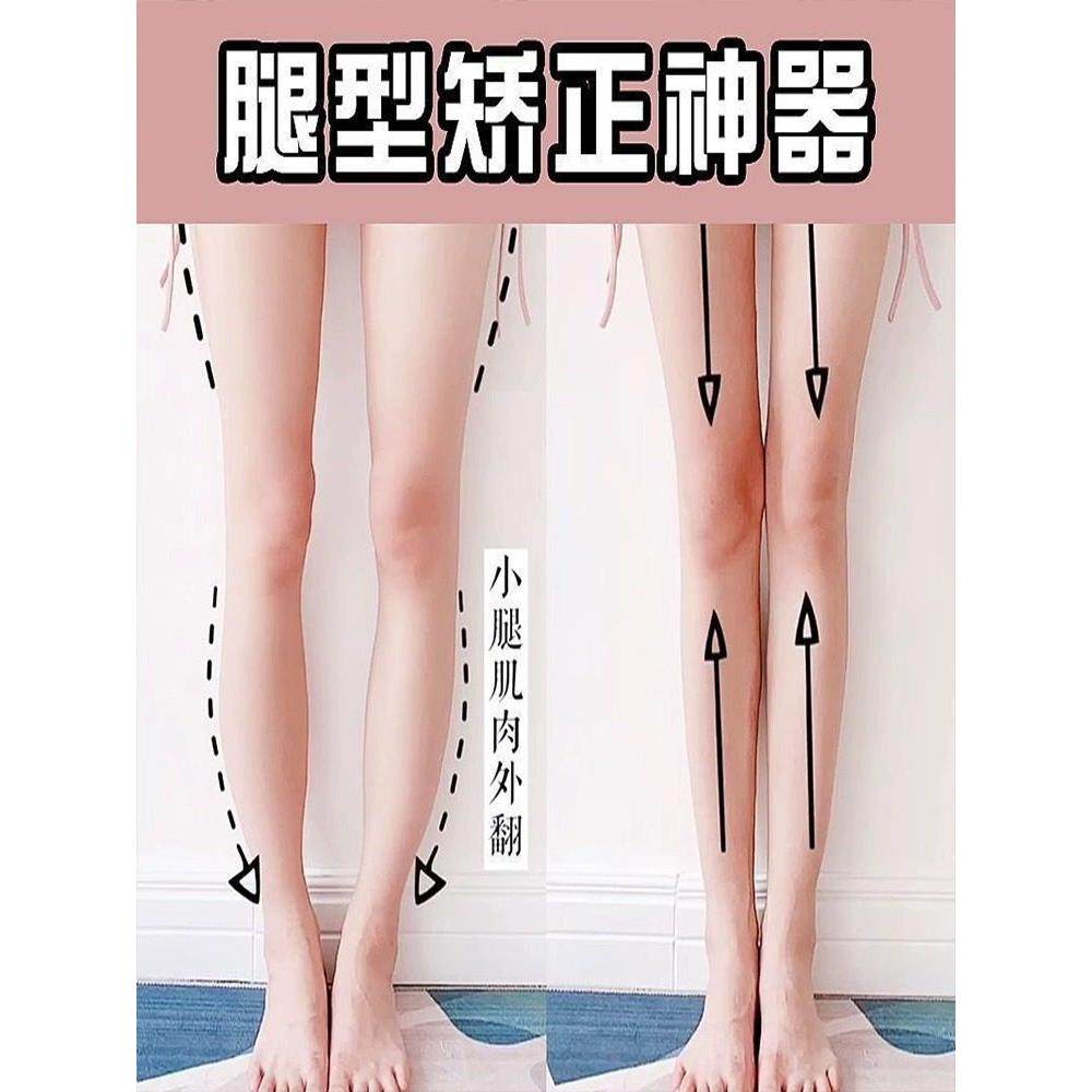 【小红书推荐】O型X型罗圈小腿外翻八纠正腿型矫正直腿神器成人儿