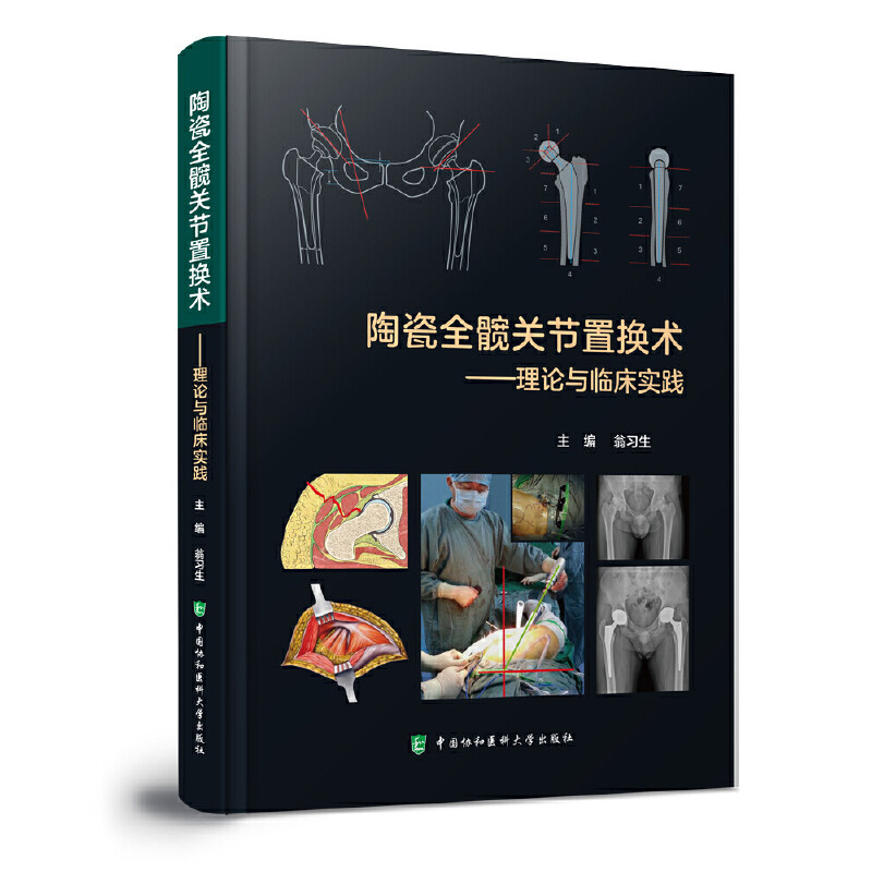 陶瓷全髋关节置换术——理论与临床实践翁习生 编9787567921351书籍\/杂志\/报纸/医学卫生/外科学