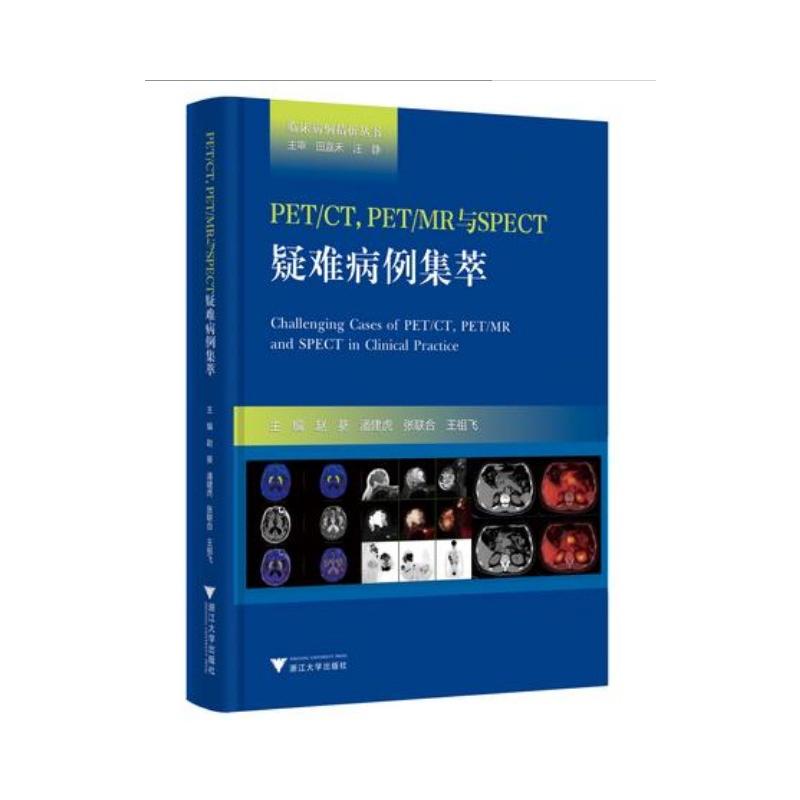 PET/CT,PET/MR与SPECT疑难病例集萃赵葵9787308204897书籍\/杂志\/报纸/医学卫生/护理学