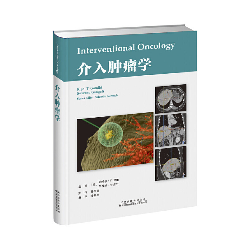 介入肿瘤学美国9787543339545书籍\/杂志\/报纸/医学卫生/肿瘤学