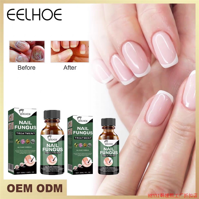 eelhoe NAIL FUNGUS TREATMENT  30ML