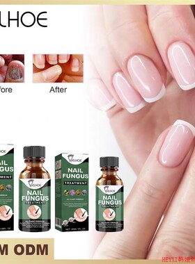 eelhoe NAIL FUNGUS TREATMENT  30ML
