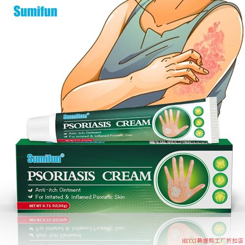Psoriasis cream Skin Ringworm Net Cream Anti-itch Ointment