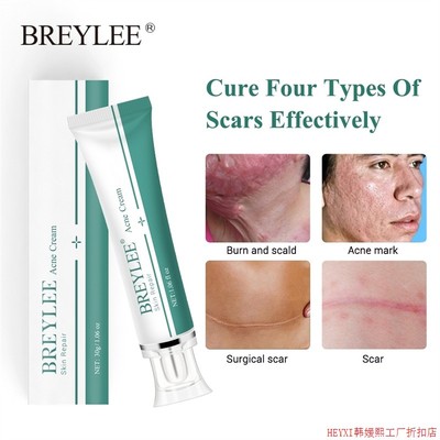 BREYLEE Remove scars Pregnant woman Stretch marks Care cream