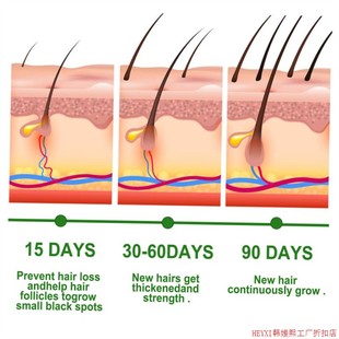 Hair Growth Care EELHOE Nourishes Serum Oil Scalp Rosemary