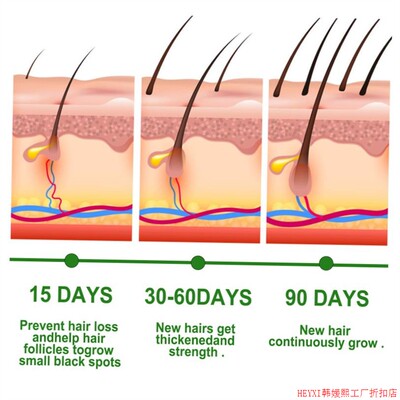 EELHOE Rosemary Serum Hair Growth Care Oil Nourishes Scalp