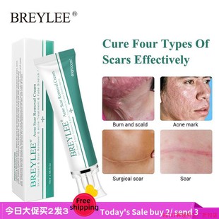 Acne Scar Removal Cream Face Repair Skin Whitening cream30g