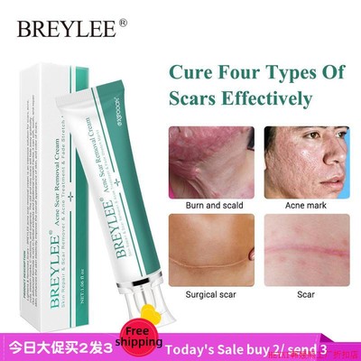 Acne Scar Removal Cream Face Repair Skin Whitening cream30g
