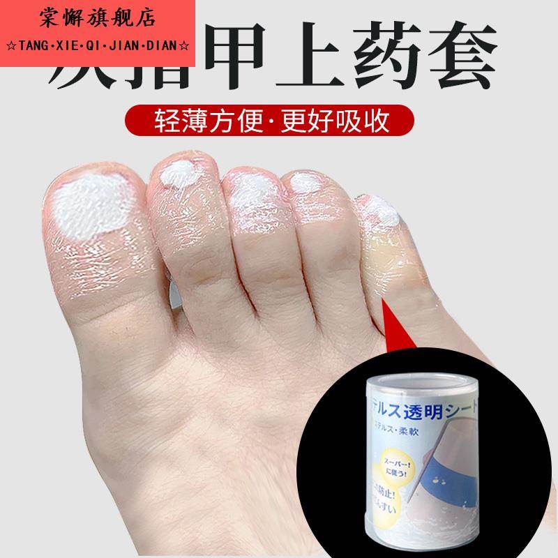 灰指甲上药套灰指甲脚趾手指保护套脚指抹药上药防护套保护脚趾