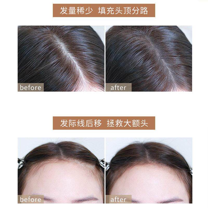 玫黛琳发际线 线修容阴影粉补 际YVL发际线线修饰轮填充廓发线 线
